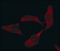 Anti-Superoxide Dismutase (MnSOD) (DD-17)&#8722;Cy3 antibody produced in rabbit 1-2&#160;mg/mL, affinity isolated antibody, buffered aqueous solution