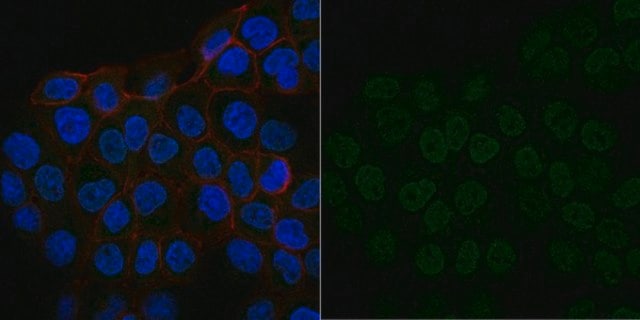 Anti-IGF-I Antibody, clone Sm1.2, Alexa Fluor&#8482; 488 Conjugate clone Sm1.2, from mouse, ALEXA FLUOR&#8482; 488
