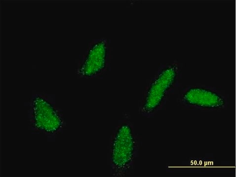 Monoclonal Anti-UBE2U antibody produced in mouse clone 3D4, purified immunoglobulin, buffered aqueous solution