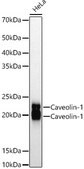 Anti-Caveolin-1 Antibody, clone 10Y5L2, Rabbit Monoclonal