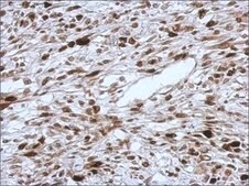 Anti-HMGA2 antibody produced in rabbit