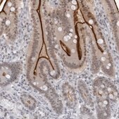 Anti-ESPN antibody produced in rabbit affinity isolated antibody, buffered aqueous glycerol solution