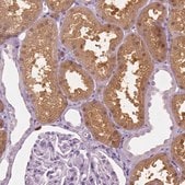 Anti-GALM antibody produced in rabbit Prestige Antibodies&#174; Powered by Atlas Antibodies, affinity isolated antibody, buffered aqueous glycerol solution