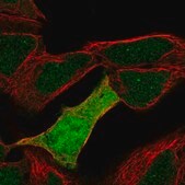 Anti-UBE2M antibody produced in rabbit Prestige Antibodies&#174; Powered by Atlas Antibodies, affinity isolated antibody, buffered aqueous glycerol solution