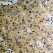 Anti-phospho-PKD1/2/3/PKC mu (pSer738+Ser742) antibody produced in rabbit affinity isolated antibody