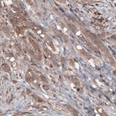 Monoclonal Anti-BRAF antibody produced in mouse Prestige Antibodies® Powered by Atlas Antibodies, clone CL4004, purified immunoglobulin