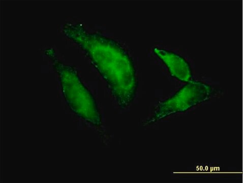 Anti-TBX20 antibody produced in mouse purified immunoglobulin, buffered aqueous solution