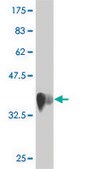 Monoclonal Anti-LOC51136 antibody produced in mouse clone 4H7, purified immunoglobulin, buffered aqueous solution