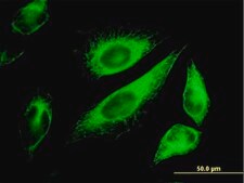 Monoclonal Anti-KRT18 antibody produced in mouse clone 2F8, purified immunoglobulin, buffered aqueous solution