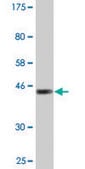 Monoclonal Anti-RTKN2 antibody produced in mouse clone 2C2, purified immunoglobulin, buffered aqueous solution