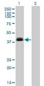 Monoclonal Anti-OTX1 antibody produced in mouse clone 1F2, purified immunoglobulin, buffered aqueous solution