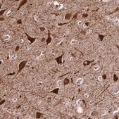Anti-SLX4IP antibody produced in rabbit Prestige Antibodies&#174; Powered by Atlas Antibodies, affinity isolated antibody, buffered aqueous glycerol solution