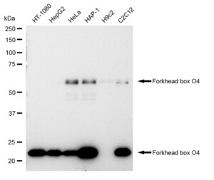 KD-Validated Anti Forkhead box O4 Antibody, clone 23GB1470, Rabbit Monoclonal clone 23GB1470, recombinant rabbit monoclonal, expressed in HEK293 cells