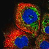 Anti-RDH13 antibody produced in rabbit Prestige Antibodies&#174; Powered by Atlas Antibodies, affinity isolated antibody, buffered aqueous glycerol solution