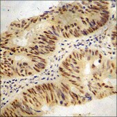 Anti-phospho-BAD (pSer136) antibody produced in rabbit affinity isolated antibody