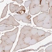 Anti-TAMM41 antibody produced in rabbit Prestige Antibodies&#174; Powered by Atlas Antibodies, affinity isolated antibody, buffered aqueous glycerol solution