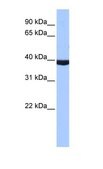 Anti-PAX2 IgG fraction of antiserum