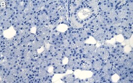 Anti-4E-BP1 Antibody, clone 1I3 ZooMAb® Rabbit Monoclonal recombinant, expressed in HEK 293 cells