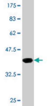 Monoclonal Anti-GBA antibody produced in mouse clone 2H4, purified immunoglobulin, buffered aqueous solution