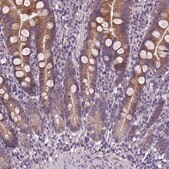 Anti-DQX1 antibody produced in rabbit Prestige Antibodies&#174; Powered by Atlas Antibodies, affinity isolated antibody, buffered aqueous glycerol solution