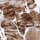 Anti-MYOT antibody produced in rabbit Prestige Antibodies&#174; Powered by Atlas Antibodies, affinity isolated antibody, buffered aqueous glycerol solution