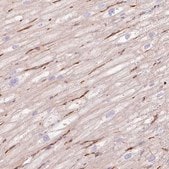 Anti-EHD3 antibody produced in rabbit Prestige Antibodies&#174; Powered by Atlas Antibodies, affinity isolated antibody, buffered aqueous glycerol solution