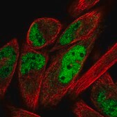 Anti-ZNF671 antibody produced in rabbit Prestige Antibodies&#174; Powered by Atlas Antibodies, affinity isolated antibody, buffered aqueous glycerol solution