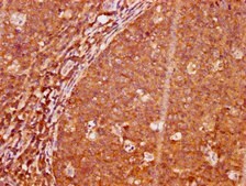 Anti-phospho-LAT (Y191) antibody, clone 2E4, Rabbit Monoclonal recombinant, expressed in HEK293F cells