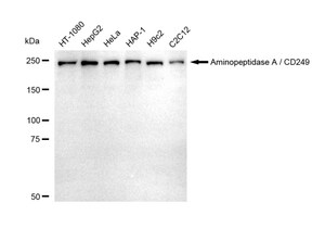 KD-Validated Anti Aminopeptidase A / CD249 Antibody, clone 23GB5325, Rabbit Monoclonal clone 23GB5325, recombinant rabbit monoclonal, expressed in HEK293 cells