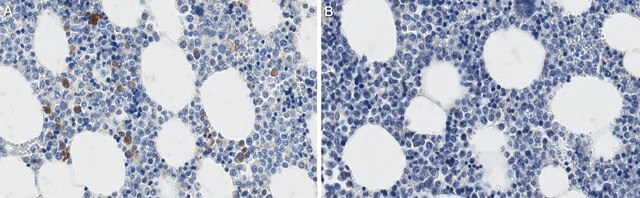 Anti-Hypoxia Inducible Factor 2&#945; Antibody, clone 190b