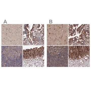 Anti-DDO antibody produced in rabbit Prestige Antibodies® Powered by Atlas Antibodies, affinity isolated antibody, buffered aqueous glycerol solution