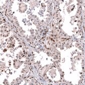 Anti-TFE3 antibody produced in mouse Prestige Antibodies&#174; Powered by Atlas Antibodies, clone CL12810, purified by using Protein A, buffered aqueous glycerol solution