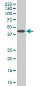 Monoclonal Anti-ZNF265, (N-terminal) antibody produced in mouse clone 2A11, purified immunoglobulin, buffered aqueous solution