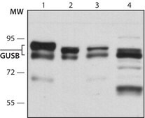 Anti-GUSB (C-terminal) antibody produced in rabbit ~1.0&#160;mg/mL, affinity isolated antibody