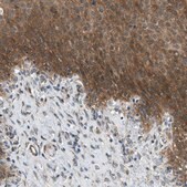 抗-EDARADD 兔抗 Prestige Antibodies&#174; Powered by Atlas Antibodies, affinity isolated antibody, buffered aqueous glycerol solution