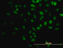 Monoclonal Anti-TRIM33 antibody produced in mouse clone 6D1, purified immunoglobulin, buffered aqueous solution