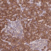 Anti-HM13 antibody produced in rabbit Prestige Antibodies&#174; Powered by Atlas Antibodies, affinity isolated antibody, buffered aqueous glycerol solution