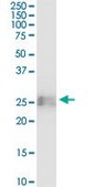 Monoclonal Anti-BST2 antibody produced in mouse clone 2E6, purified immunoglobulin, buffered aqueous solution