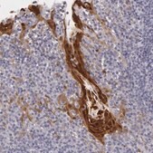 Anti-IL1RN antibody produced in rabbit Prestige Antibodies&#174; Powered by Atlas Antibodies, affinity isolated antibody, buffered aqueous glycerol solution