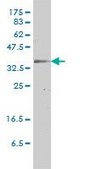 Monoclonal Anti-GJB3 antibody produced in mouse clone 3B4-1B3, purified immunoglobulin, buffered aqueous solution