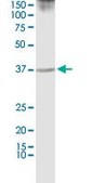 Monoclonal Anti-PURA antibody produced in mouse clone 3F10, purified immunoglobulin, buffered aqueous solution