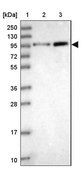 Anti-ANAPC4 antibody produced in rabbit Prestige Antibodies&#174; Powered by Atlas Antibodies, affinity isolated antibody, buffered aqueous glycerol solution