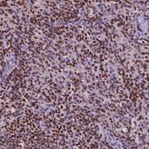 Anti-AKAP17A antibody produced in rabbit Prestige Antibodies&#174; Powered by Atlas Antibodies, affinity isolated antibody, buffered aqueous glycerol solution