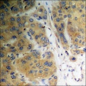 Anti-phospho-Vinculin (pTyr821) antibody produced in rabbit affinity isolated antibody