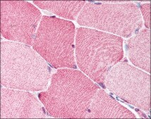 Anti-BRCC3 antibody produced in rabbit affinity isolated antibody, buffered aqueous solution