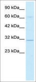 Anti-DBP (AB1) antibody produced in rabbit affinity isolated antibody