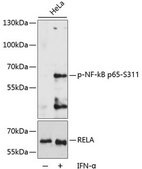Anti-Phospho-NF-kB p65-S311 antibody produced in rabbit