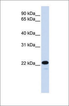 Anti-CDKN1B antibody produced in rabbit affinity isolated antibody