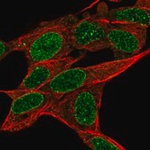 Anti-RADIL antibody produced in rabbit Prestige Antibodies&#174; Powered by Atlas Antibodies, affinity isolated antibody, buffered aqueous glycerol solution