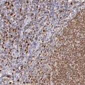 Anti-IRF8 antibody produced in rabbit affinity isolated antibody, buffered aqueous glycerol solution